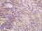 Metal regulatory transcription factor 1 antibody, GTX60279, GeneTex, Immunohistochemistry paraffin image 