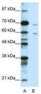 Forkhead Box A2 antibody, TA345338, Origene, Western Blot image 