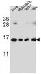H2A Histone Family Member J antibody, GTX53601, GeneTex, Western Blot image 