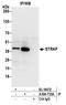 Serine/Threonine Kinase Receptor Associated Protein antibody, A304-735A, Bethyl Labs, Immunoprecipitation image 