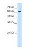 Cholinergic Receptor Nicotinic Epsilon Subunit antibody, orb331575, Biorbyt, Western Blot image 