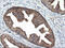 RAB21, Member RAS Oncogene Family antibody, M05683-2, Boster Biological Technology, Immunohistochemistry paraffin image 