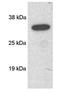 Secretory Carrier Membrane Protein 1 antibody, GTX23430, GeneTex, Western Blot image 
