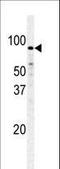 Pfk-m antibody, LS-C101265, Lifespan Biosciences, Western Blot image 
