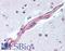 Mitogen-Activated Protein Kinase 9 antibody, LS-B2052, Lifespan Biosciences, Immunohistochemistry paraffin image 