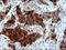 Serpin Family B Member 3 antibody, LS-C788345, Lifespan Biosciences, Immunohistochemistry paraffin image 