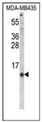Hepcidin Antimicrobial Peptide antibody, AP51998PU-N, Origene, Western Blot image 