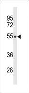 Zinc Finger And SCAN Domain Containing 5C antibody, PA5-49221, Invitrogen Antibodies, Western Blot image 