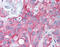 ERBB2 antibody, 49-999, ProSci, Immunohistochemistry paraffin image 