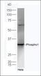Phosphoethanolamine/phosphocholine phosphatase antibody, orb155523, Biorbyt, Western Blot image 