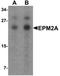 Laforin antibody, orb75843, Biorbyt, Western Blot image 