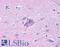 Neuropeptide Y Receptor Y5 antibody, LS-A1074, Lifespan Biosciences, Immunohistochemistry paraffin image 