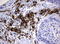 CD32a antibody, LS-C796732, Lifespan Biosciences, Immunohistochemistry paraffin image 