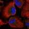Centrosomal Protein 170 antibody, HPA045597, Atlas Antibodies, Immunocytochemistry image 