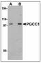 Family With Sequence Similarity 120B antibody, AP23486PU-N, Origene, Western Blot image 