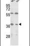 Isocitrate Dehydrogenase (NAD(+)) 3 Alpha antibody, PA5-11756, Invitrogen Antibodies, Western Blot image 