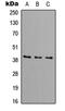 DNA Fragmentation Factor Subunit Beta antibody, abx121592, Abbexa, Western Blot image 