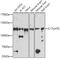 FA Core Complex Associated Protein 100 antibody, 23-678, ProSci, Western Blot image 