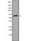 Carcinoembryonic Antigen Related Cell Adhesion Molecule 20 antibody, abx149188, Abbexa, Western Blot image 
