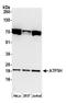 ATP Synthase Peripheral Stalk Subunit D antibody, A305-491A, Bethyl Labs, Western Blot image 