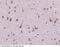 Platelet Derived Growth Factor Receptor Beta antibody, 90215-T24, Sino Biological, Immunohistochemistry paraffin image 