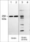 Coiled-Coil Domain Containing 88A antibody, GP5791, ECM Biosciences, Western Blot image 