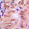 SMAD Family Member 1 antibody, LS-C358321, Lifespan Biosciences, Immunohistochemistry paraffin image 