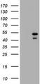 Parvin Beta antibody, TA505695AM, Origene, Western Blot image 
