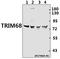 Tripartite Motif Containing 68 antibody, A11532-1, Boster Biological Technology, Western Blot image 