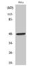 Coagulation Factor II Thrombin Receptor antibody, STJ96010, St John