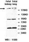 Ankyrin Repeat Domain 36 antibody, orb154811, Biorbyt, Western Blot image 