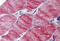 Myosin VB antibody, MBS241891, MyBioSource, Immunohistochemistry frozen image 
