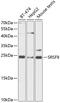 Serine/arginine-rich splicing factor 9 antibody, 14-491, ProSci, Western Blot image 