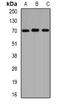 5'-Aminolevulinate Synthase 1 antibody, LS-C482631, Lifespan Biosciences, Western Blot image 