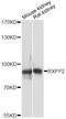 Relaxin Family Peptide Receptor 2 antibody, LS-C749303, Lifespan Biosciences, Western Blot image 