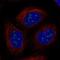 Ubiquitin Conjugating Enzyme E2 W antibody, NBP2-57789, Novus Biologicals, Immunofluorescence image 