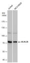 Kelch Like Family Member 26 antibody, GTX120879, GeneTex, Western Blot image 