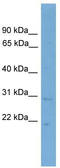Protein canopy homolog 3 antibody, TA344530, Origene, Western Blot image 