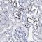ATPase H+ Transporting V0 Subunit A4 antibody, NBP1-89330, Novus Biologicals, Immunohistochemistry frozen image 