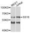 SS18 Subunit Of BAF Chromatin Remodeling Complex antibody, abx006411, Abbexa, Western Blot image 