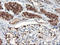 F-Box Protein 21 antibody, LS-C173533, Lifespan Biosciences, Immunohistochemistry paraffin image 
