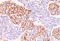 Phosphotyrosine antibody, AM33265PU-T, Origene, Immunohistochemistry frozen image 