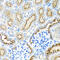 Ribosomal Protein S2 antibody, 22-442, ProSci, Immunohistochemistry paraffin image 