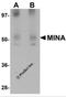 Ribosomal Oxygenase 2 antibody, 5617, ProSci Inc, Western Blot image 