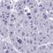 Zinc Finger Protein 684 antibody, HPA059153, Atlas Antibodies, Immunohistochemistry paraffin image 