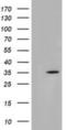 Short Chain Dehydrogenase/Reductase Family 9C Member 7 antibody, NBP2-03030, Novus Biologicals, Western Blot image 