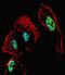 Retinoic Acid Receptor Beta antibody, PA5-35206, Invitrogen Antibodies, Immunofluorescence image 