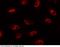 Vitamin D3 receptor antibody, 101024-T10, Sino Biological, Immunohistochemistry frozen image 