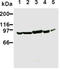Phosphatidylinositol 3-kinase regulatory subunit alpha antibody, ADI-KAM-PI200-E, Enzo Life Sciences, Western Blot image 