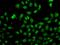 GC-A antibody, PA5-77127, Invitrogen Antibodies, Immunofluorescence image 